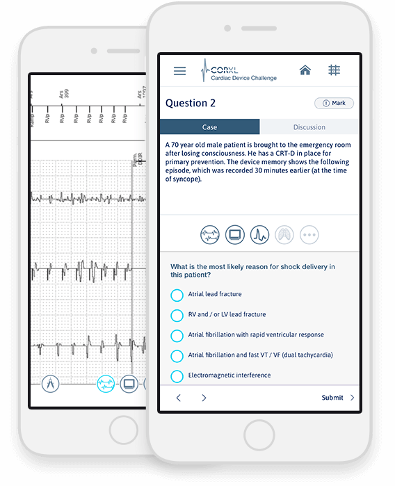 CorXL Cardiac Device Challenge Cardiac Arrhythmia Challenge Advanced cardiac device training apps