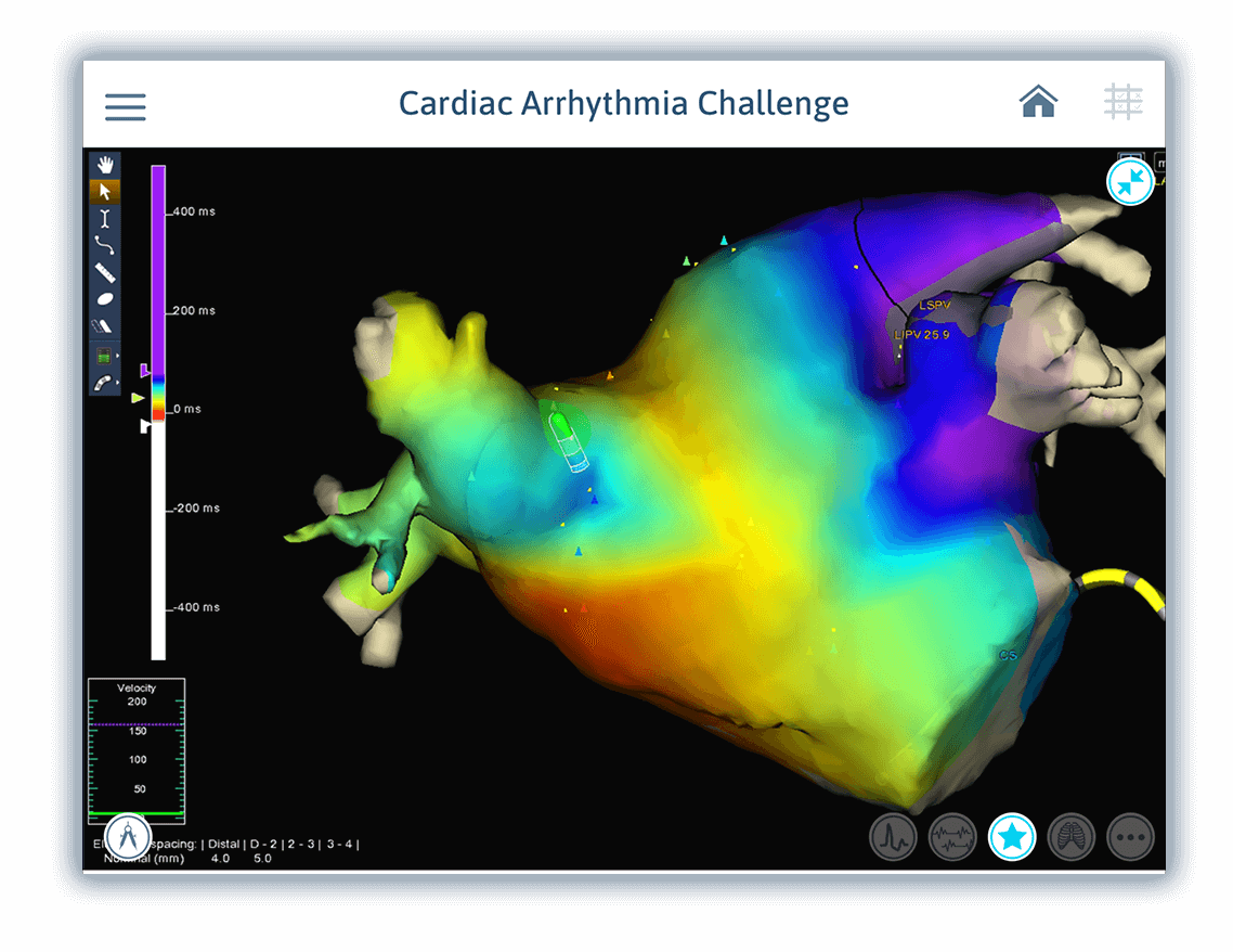 Cardiac Arrhythmia Challenge CorXL Advanced cardiac device training
