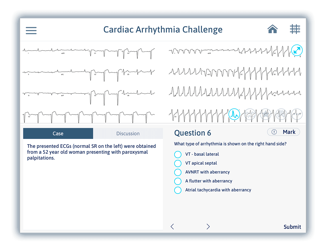 Cardiac Arrhythmia Challenge CorXL Advanced cardiac device training