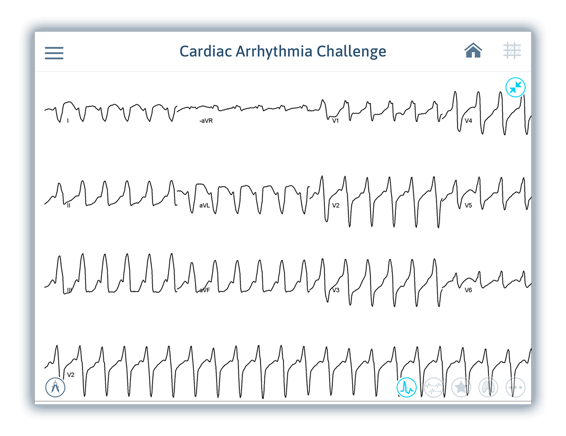 Cardiac Arrhythmia Challenge CorXL Advanced cardiac device training